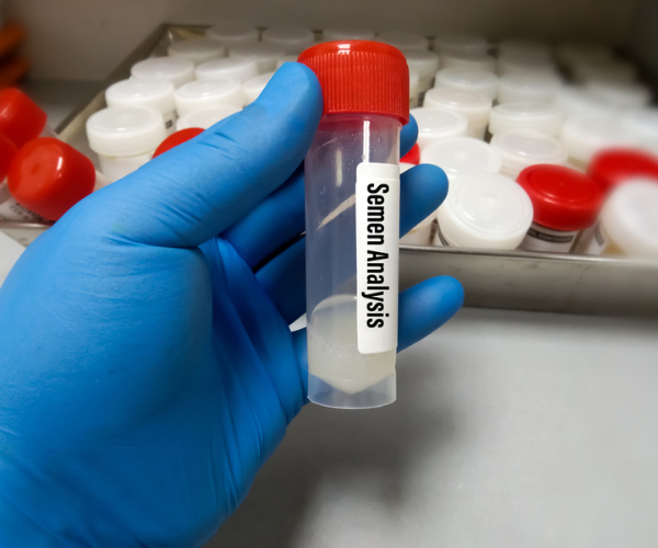Semen Analysis test in PCMC, pune by Dr. Tejas Gundewar at Jeevanam Clinic