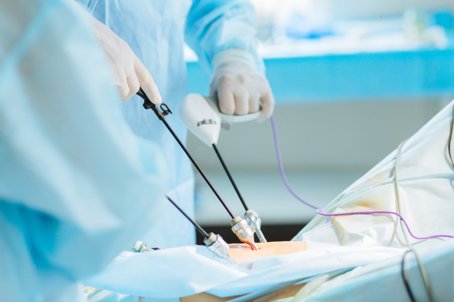 laparoscopy Surgery in Pimpri Chinchwad
