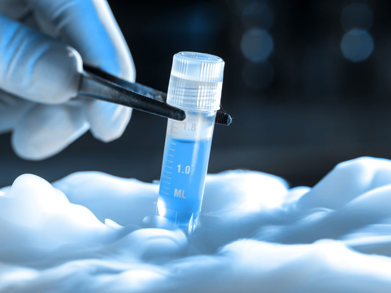 Sperm Freezing Process in PCMC, Pune by Dr. Tejas Gundewar at Jeevanam Clinic